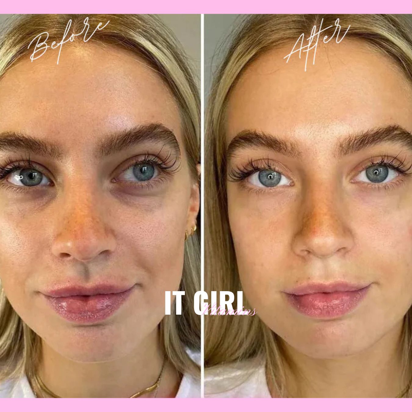 It Girl Skin – Skin Food It Girl Vitamins