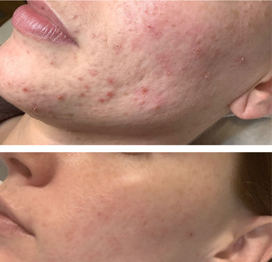 It Girl Skin – Skin Food It Girl Vitamins