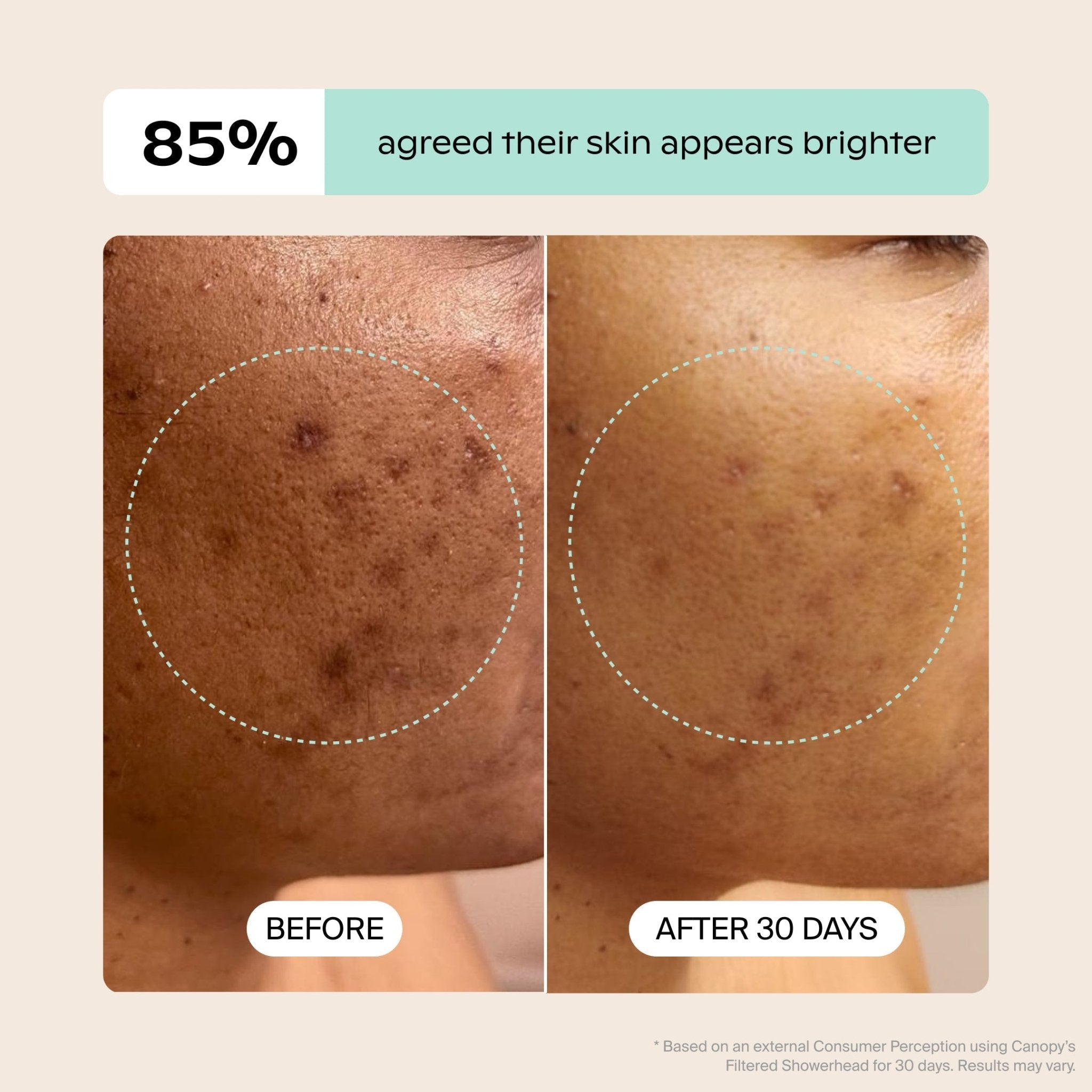 Filtered Showerhead Canopy