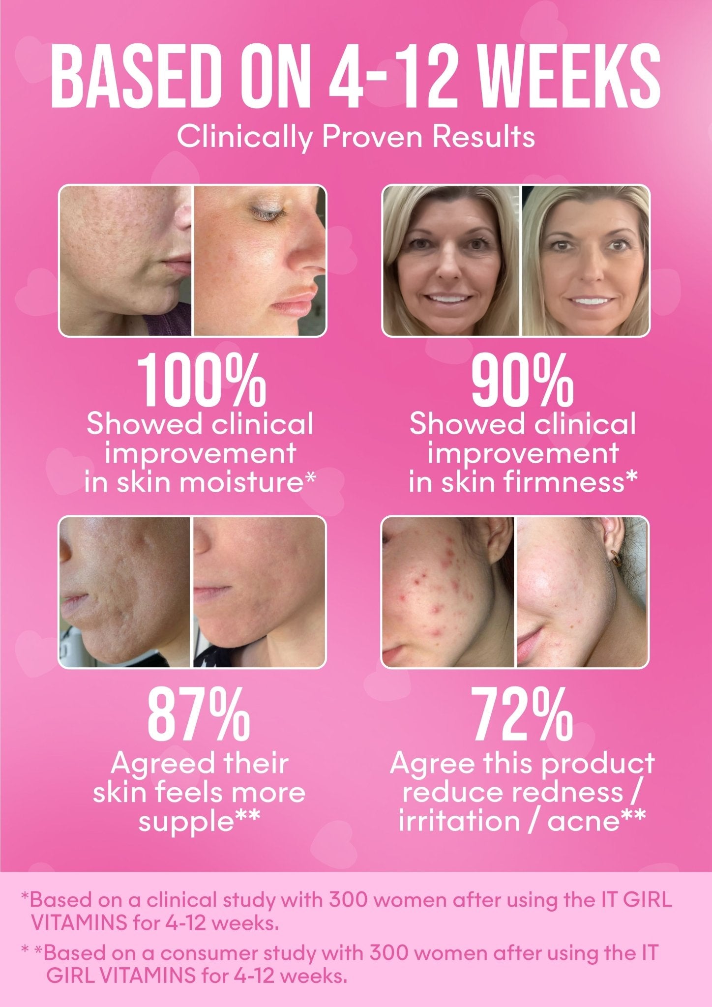 It Girl Skin – Skin Food It Girl Vitamins