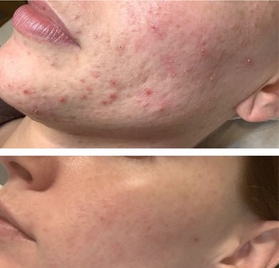 It Girl Skin – Skin Food It Girl Vitamins