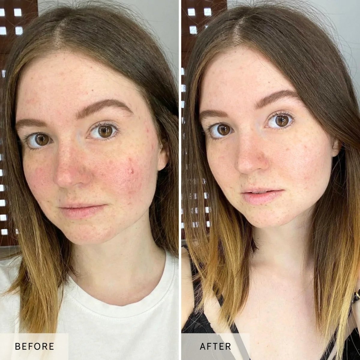 Nicebeam LED Red Light Therapy Face Mask Nicebeam