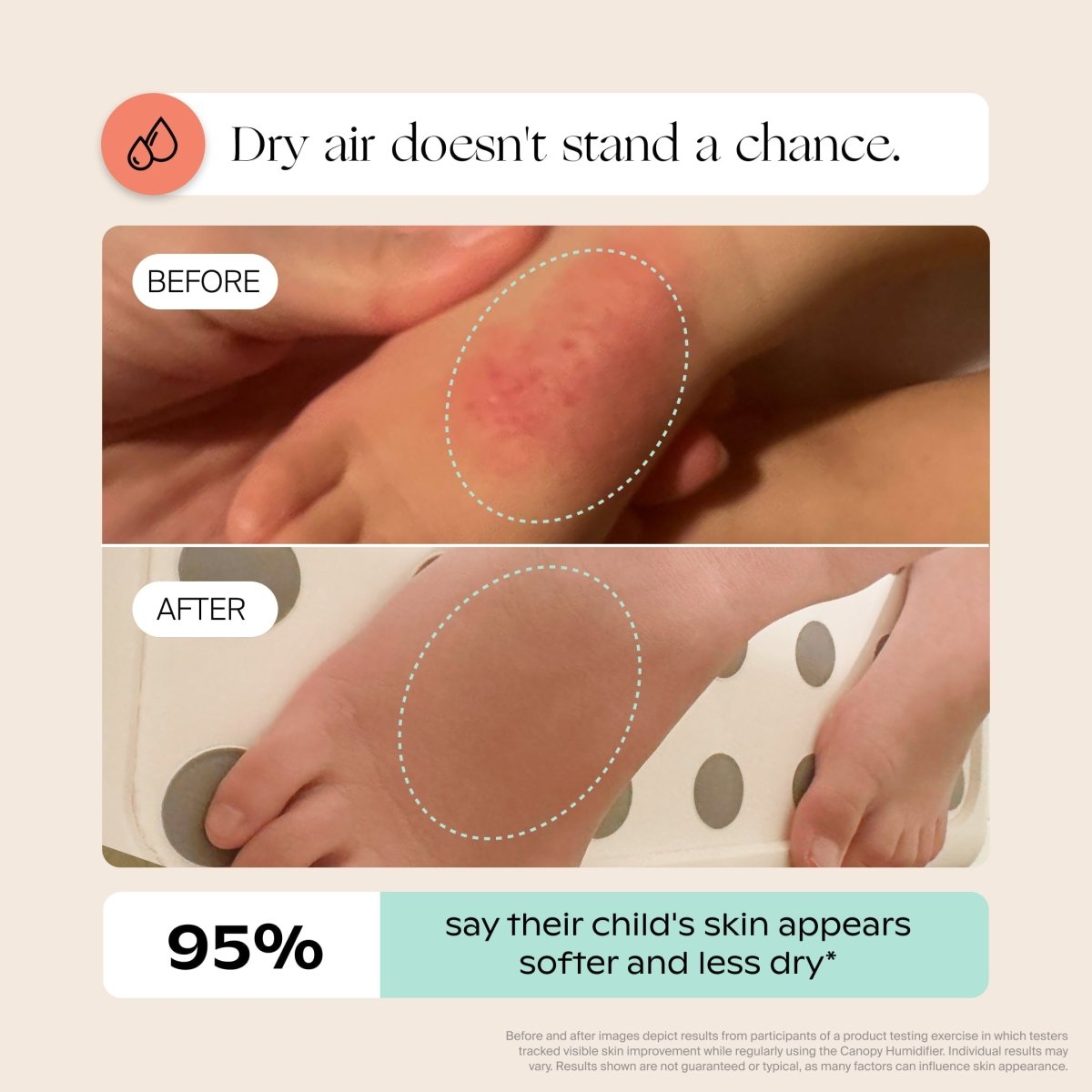 Nursery Humidifier 2.0 Canopy