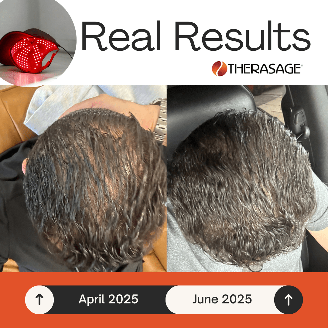TheraCap Red Light Therapy Hair & Scalp Device Therasage