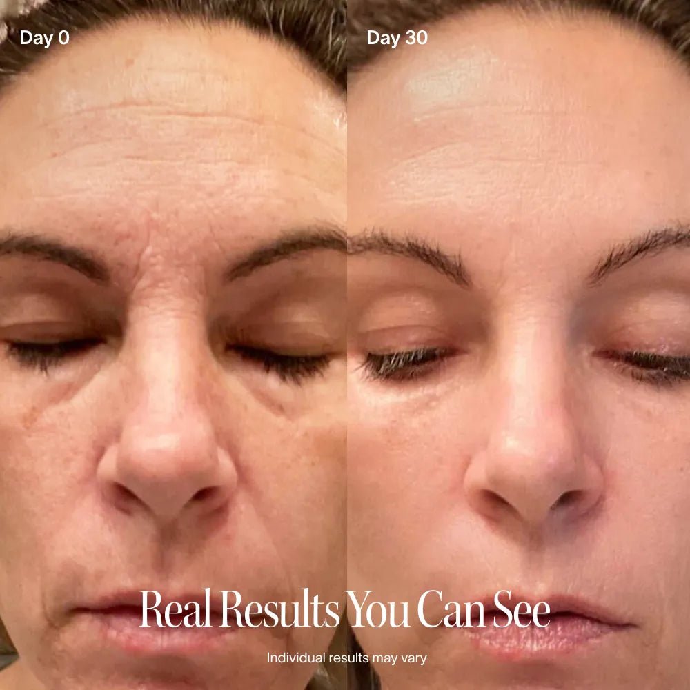 4 - in - 1 Red Light Therapy Wand & Activating Serum Kit Solawave