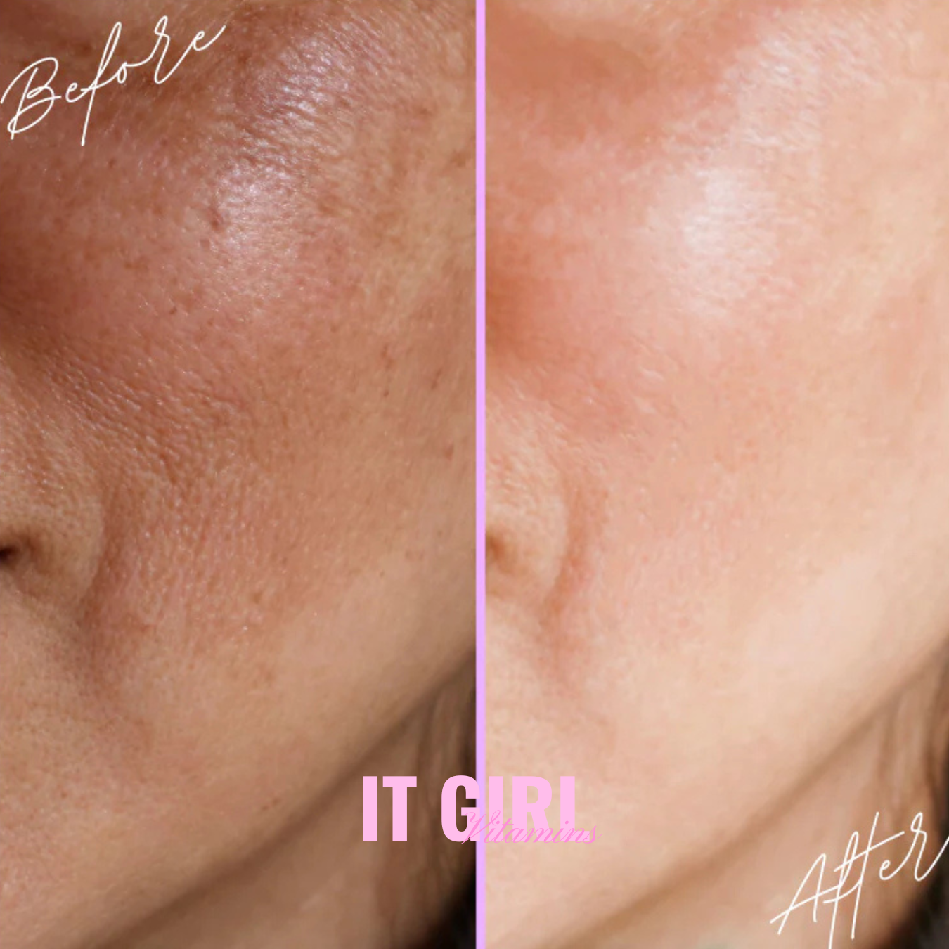 It Girl Skin – Skin Food It Girl Vitamins