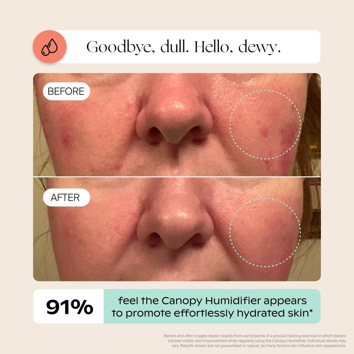 Bedside Humidifier 2.0 Canopy