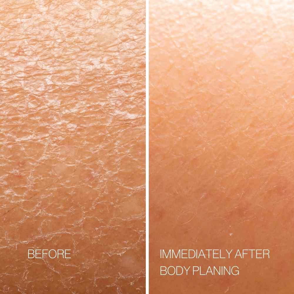 Body Plane Set Esker