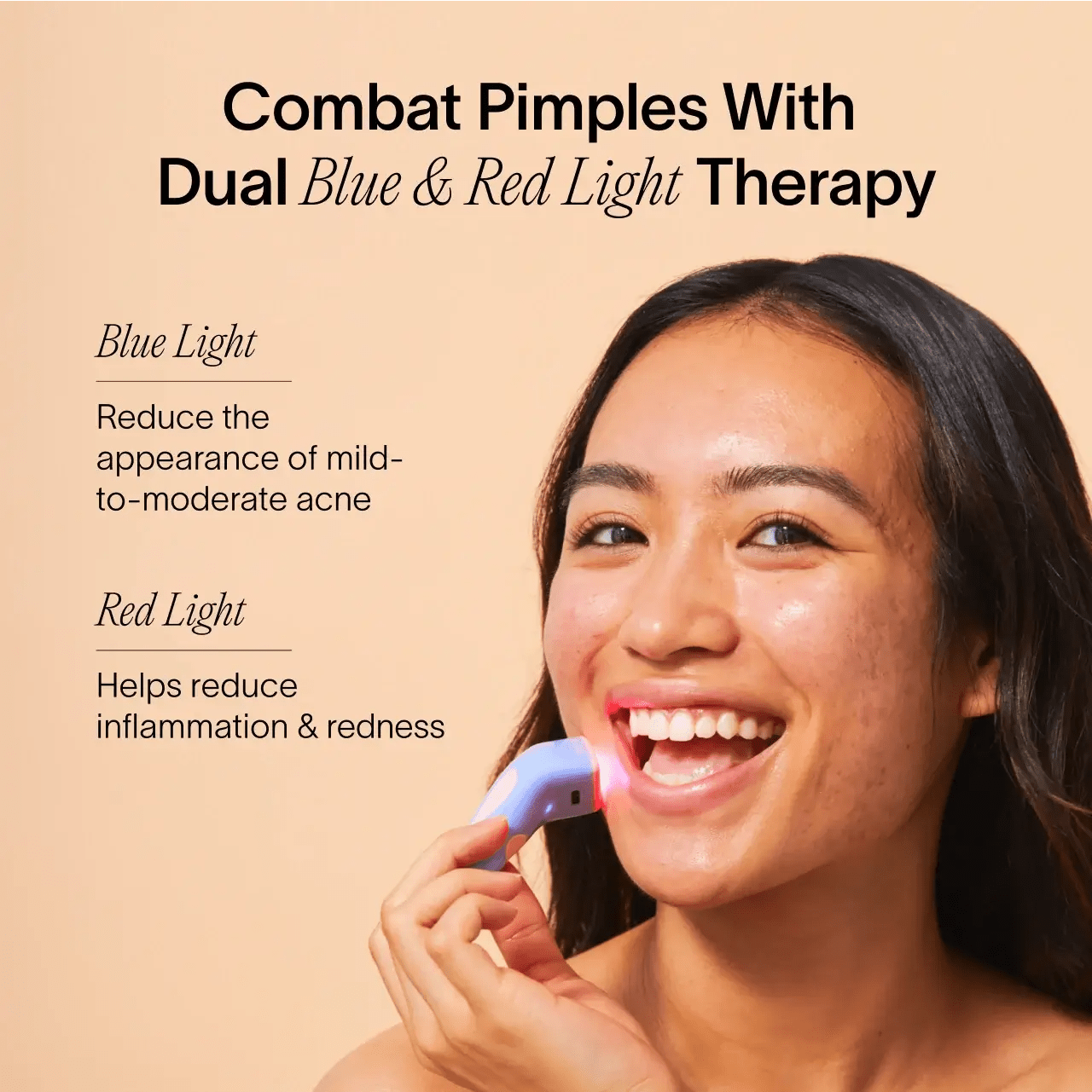 Bye Acne: 3 - Minute Pimple Spot Treatment Solawave