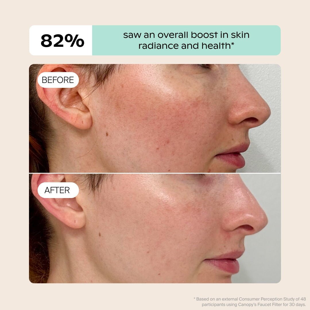 Faucet Filter Canopy