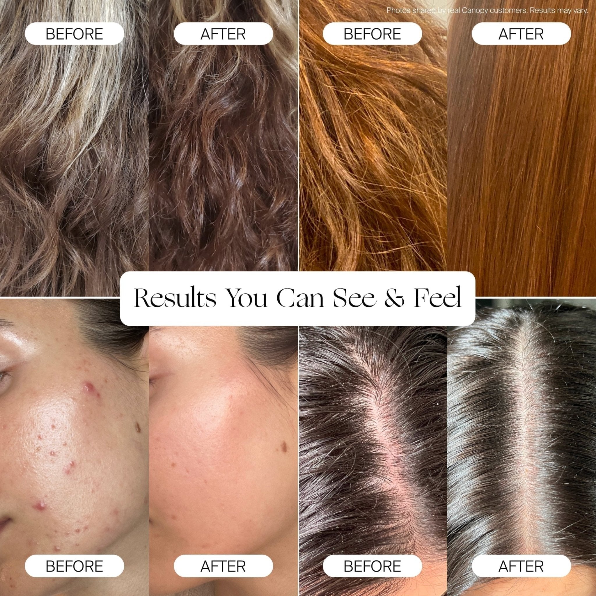 Filtered Showerhead Canopy