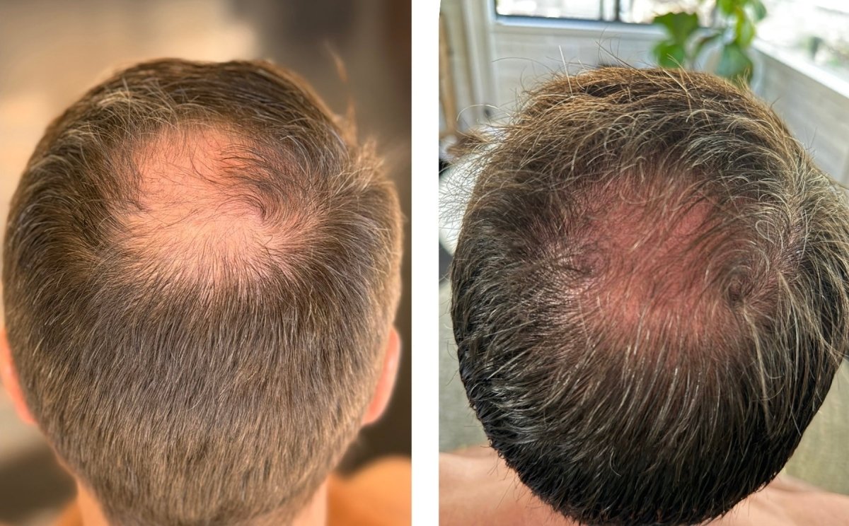 Hair Support Serum Wizard Sciences