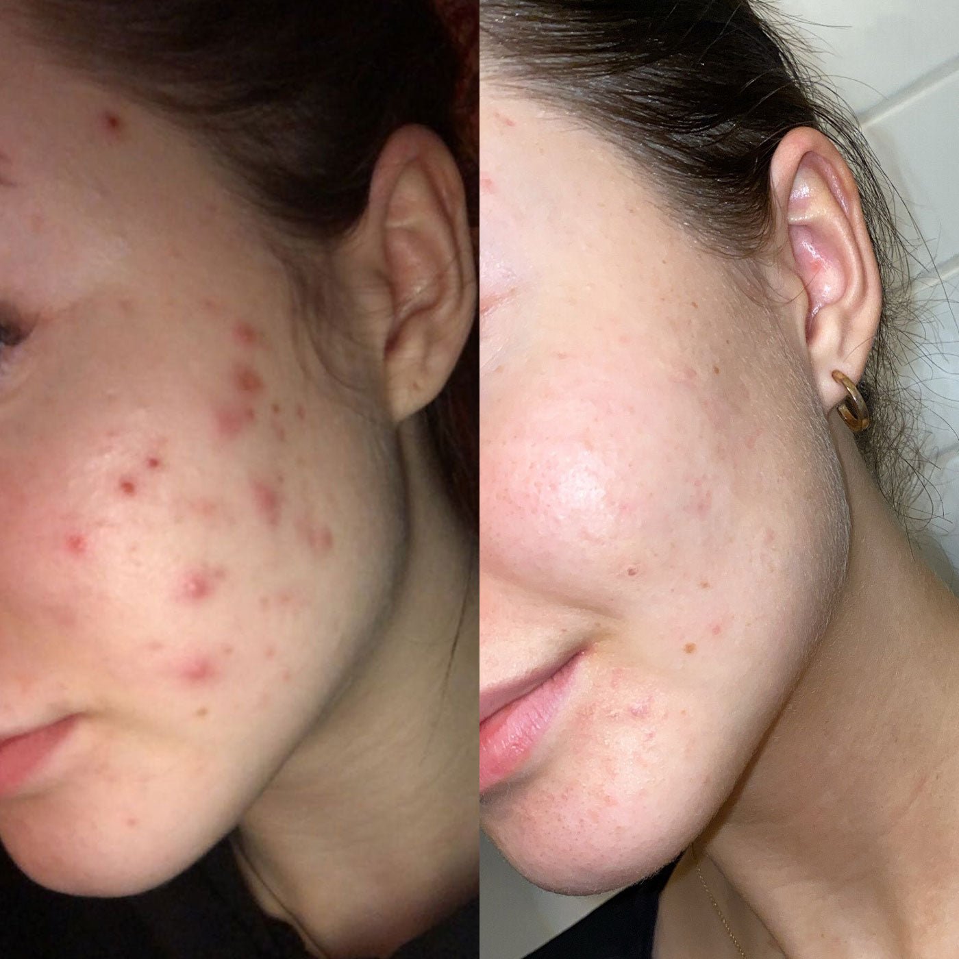 It Girl Skin – Skin Food It Girl Vitamins