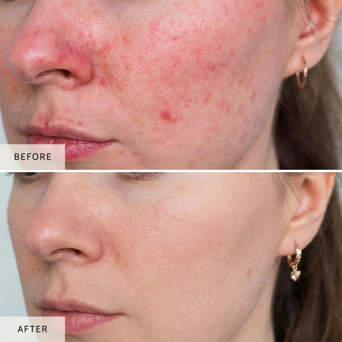 Nicebeam LED Red Light Therapy Face Mask Nicebeam
