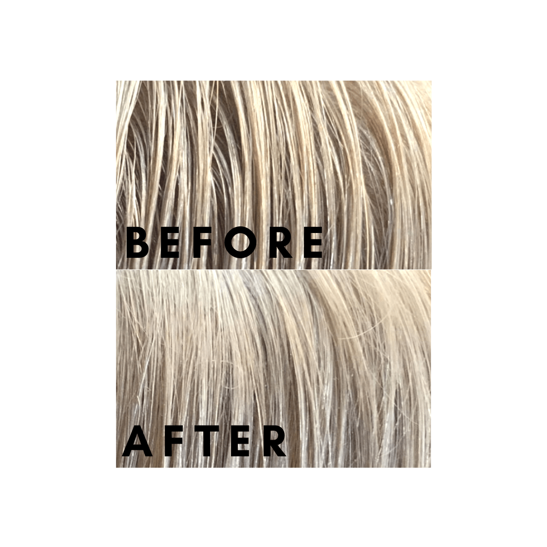 Scalpfix™ Carter + Jane