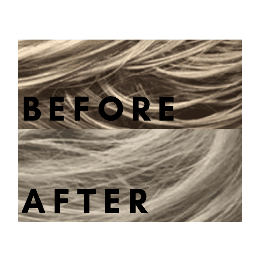 Scalpfix™ Carter + Jane